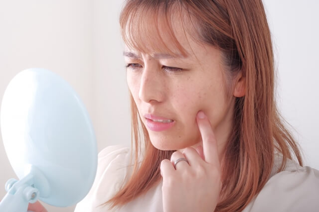 顔のシミを気にしている女性